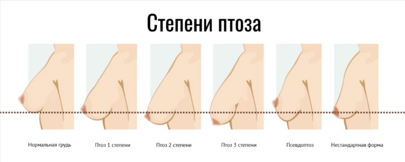 Фоновое изображение