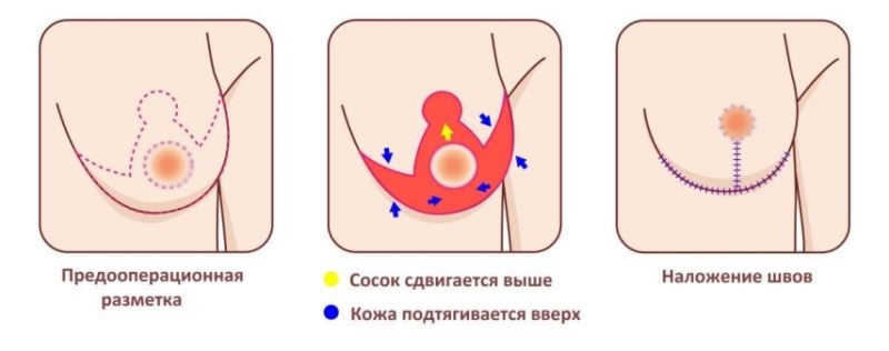 Фоновое изображение