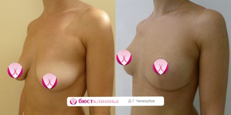 Фоновое изображение