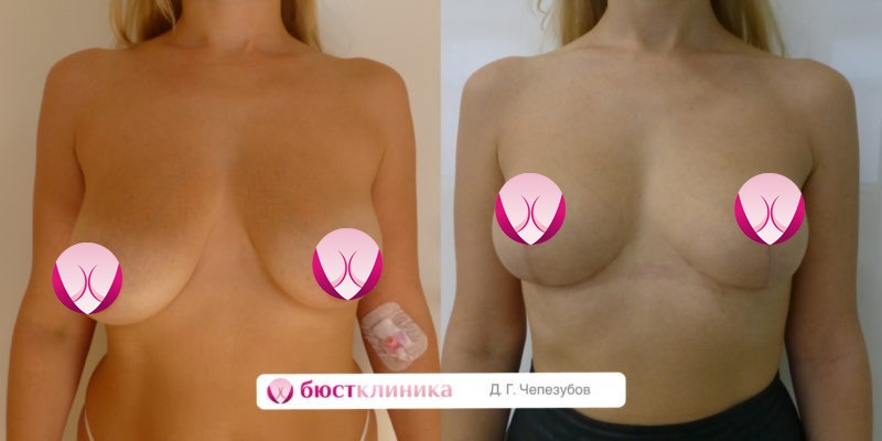 Фоновое изображение